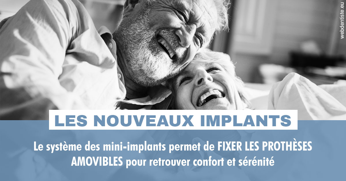 https://www.drfan.fr/Les nouveaux implants 2