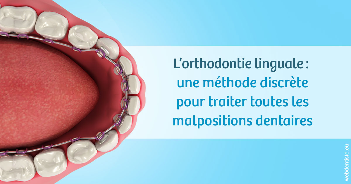 https://www.drfan.fr/L'orthodontie linguale 1
