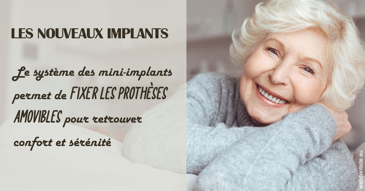 https://www.drfan.fr/Les nouveaux implants 1