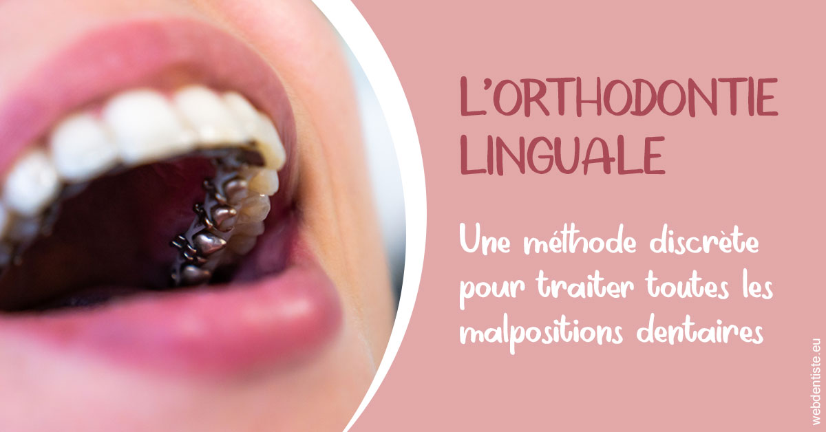 https://www.drfan.fr/L'orthodontie linguale 2
