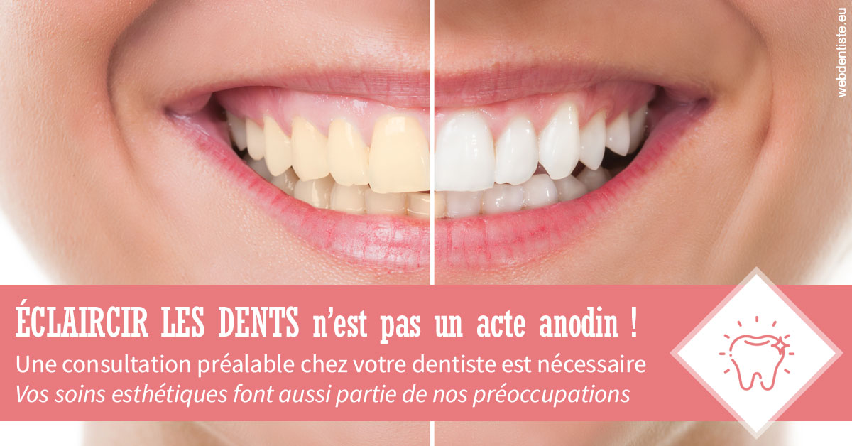 https://www.drfan.fr/Eclaircir les dents 1