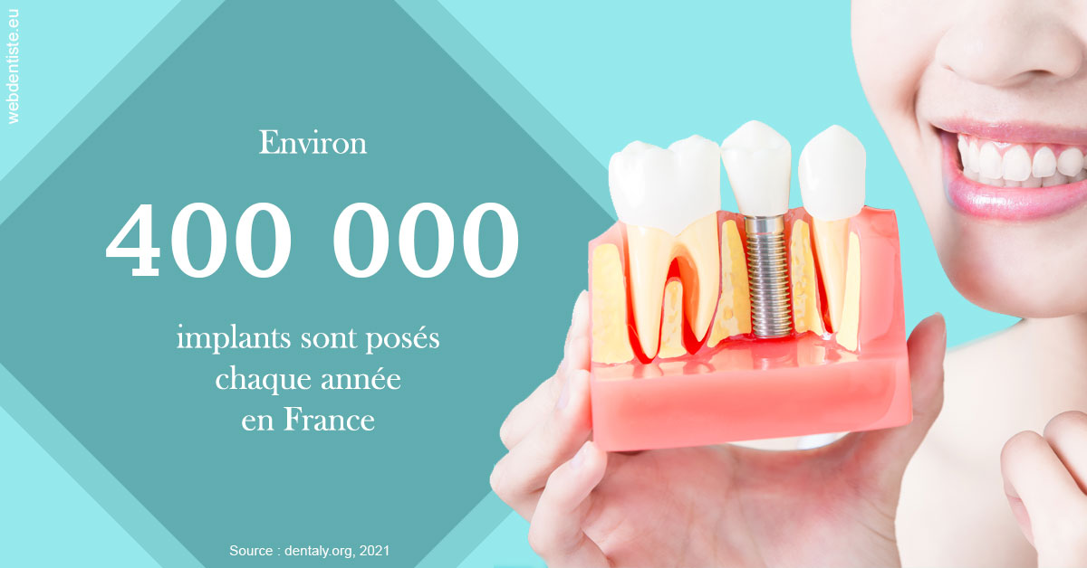 https://www.drfan.fr/Pose d'implants en France 2